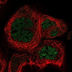 RABGGTA Antibody, Novus Biologicals 25 &mu;L; Unlabeled:Antibodies, Polyclonal